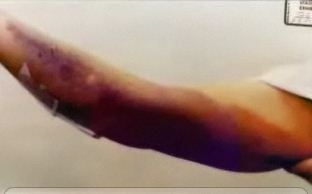 arm.jpg