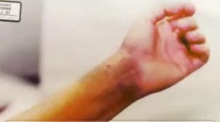 arm31.jpg