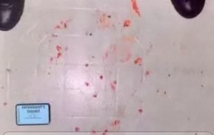 blood-spatter.jpg