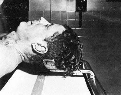 jfk_autopsy1.jpg