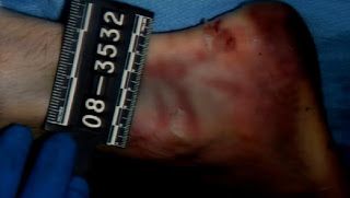 travis%20alexander%20autopsy%20photo%20feet.jpg