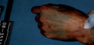 travis%20alexander%20autopsy%20photos%20hand.jpg