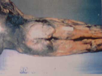 carol-bundy-coroner-10.jpg