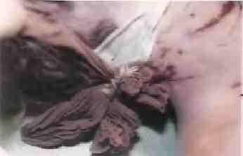 btk-killer-death-pics-018.jpg