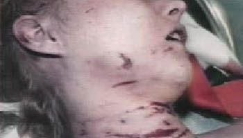 btk-killer-death-pics-033.jpg
