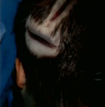 Head%20Gash.jpg