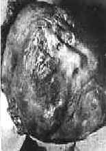 Emmitt_Till_after_beating.jpg