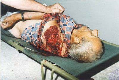 varvarin-bridge-bombing-aftermath-002.jpg
