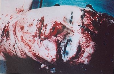 autopsy-colette01.jpg