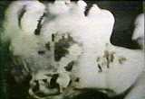 Autopsy-Kimberly02b.jpg