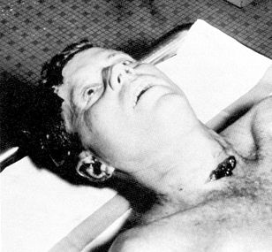 autopsy.jpg