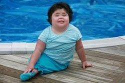 Mermaid-Syndrome-Pictures.jpg
