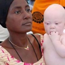 5202-albino-20child-20with-20mother_225x225.jpeg