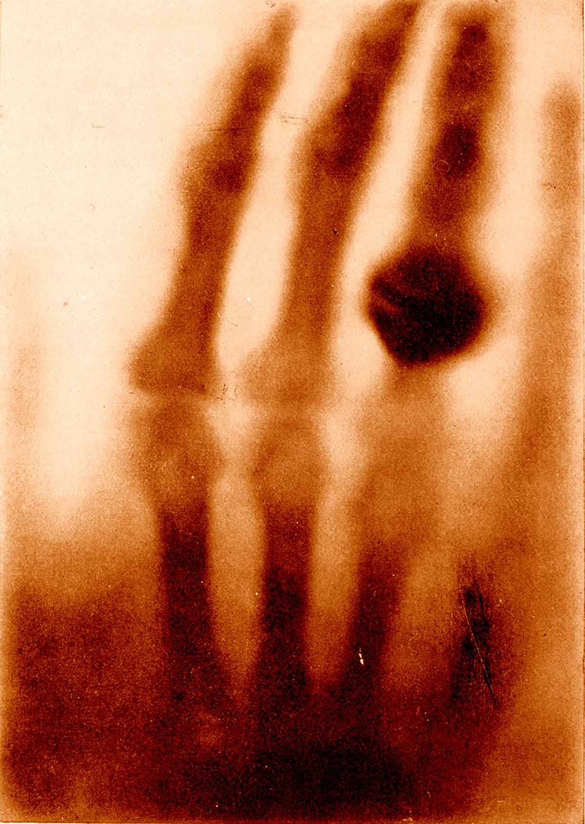 the-first-xray.jpg