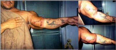 victims_of_synthol_26.jpg