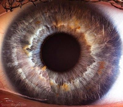eye29.img_assist_custom-600x522.jpg