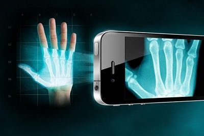 xray.jpg