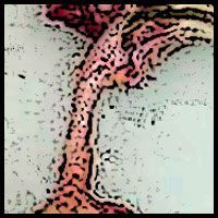 Name:  esophagus.jpg
Views: 637
Size:  16.1 KB