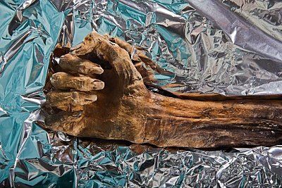 01-iceman-arm-thaws-670.jpg
