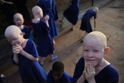 albinos_01.jpg
