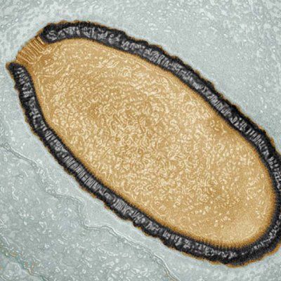 pithovirus-oldest-virus.jpg