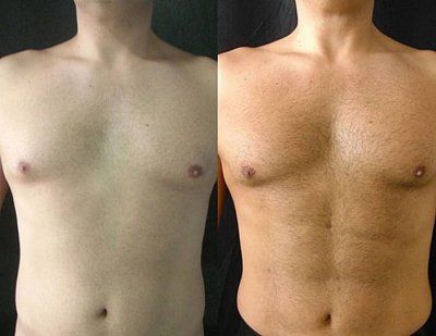 surgery_07.jpg