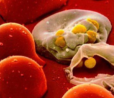 hiv2-20-281-29.jpg