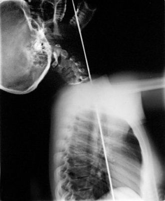 xray_jewels_01.jpg