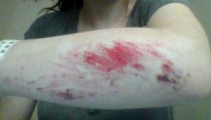 Name:  attempted-abduction-victim-abrasion.jpg
Views: 3022
Size:  15.0 KB