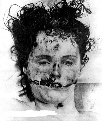 651054d1447192619-crime-scene-pictures-black-dahlia-murder-bethmrgl.jpg