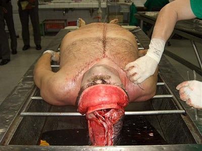 10601-performing-autopsy-kitchen-toolsbig3.jpg