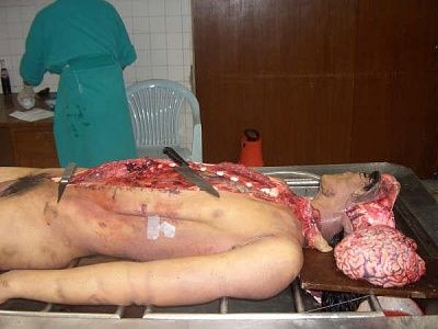 10601-performing-autopsy-kitchen-toolsbig4.jpg