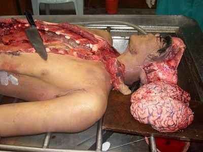 10601-performing-autopsy-kitchen-toolsbig5.jpg