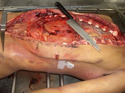 10601-performing-autopsy-kitchen-toolsbig6.jpg