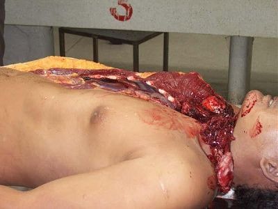 10601-performing-autopsy-kitchen-toolsbig12.jpg