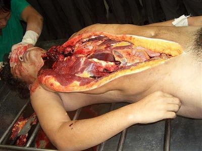 10601-performing-autopsy-kitchen-toolsbig13.jpg