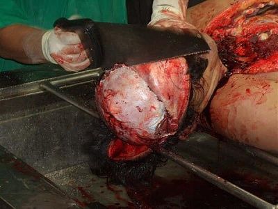 10601-performing-autopsy-kitchen-toolsbig17.jpg