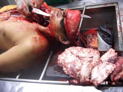 10601-performing-autopsy-kitchen-toolsbig19.jpg