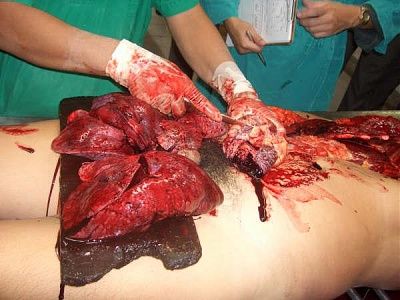10601-performing-autopsy-kitchen-toolsbig21.jpg