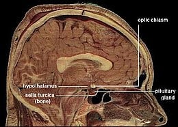 260px-locationofhypothalamus.jpg