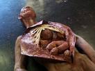 autopsy4.jpg