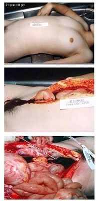female-autopsy.jpg