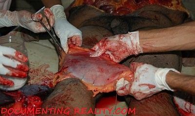 autopsy1.jpg
