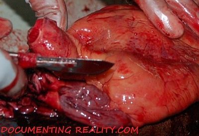autopsy2.jpg