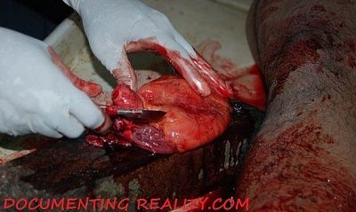 autopsy3.jpg
