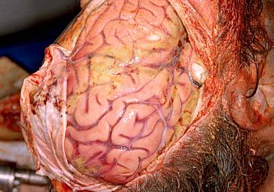 Name:  Brain2.jpg
Views: 18307
Size:  27.6 KB