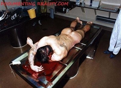 autopsy3.jpg