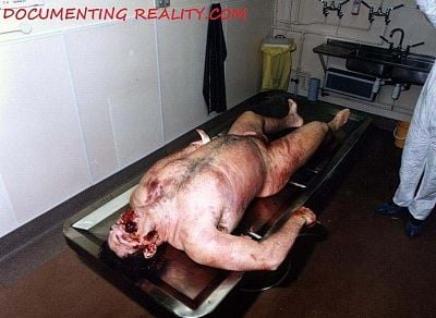 autopsy4.jpg
