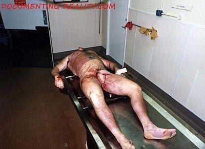 autopsy5.jpg