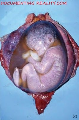 pregnant-mum2.jpg